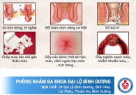 Ngứa hậu môn - Nguyên nhân và cách hỗ trợ điều trị hiệu quả
