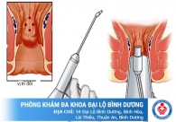 Những giải pháp hiệu quả cho bệnh nhân bệnh trĩ