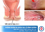 Nứt hậu môn, rách hậu môn có nguy hiểm không?