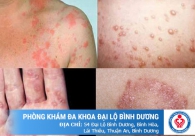 Bệnh lậu có dẫn đến vô sinh hay không