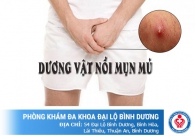 Cu nổi mụn nước thì phải làm sao