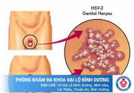 Mụn cóc sinh dục là bệnh gì