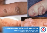 Xét nghiệm máu phát hiện được những bệnh xã hội nào