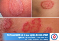 Trung tâm khám và hỗ trợ điều trị bệnh xã hội uy tín tại Bình Dương