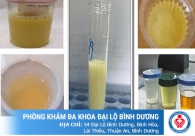 Nước tiểu có màu trắng đục là dấu hiệu của những bệnh gì