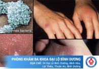 Điều trị bệnh lậu bao lâu thì khỏi bệnh