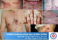 Hình ảnh thực tế của bệnh giang mai