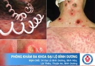 Giá xét nghiệm bệnh xã hội là bao nhiêu
