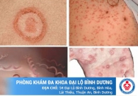 Tư vấn bệnh xã hội miễn phí cùng với bác sĩ chuyên khoa