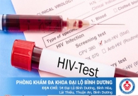 Triệu chứng để nhận biết bị nhiễm HIV