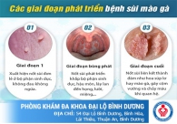 Triệu chứng nhận biết bệnh sùi mào gà