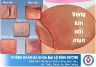 Đừng xem thường hiện tượng cậu nhỏ nổi mụn