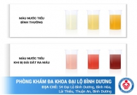 Đi tiểu ra máu là bệnh gì, nguy hiểm ra sao