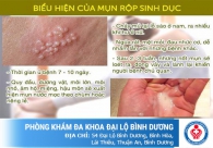 Mụn rộp sinh dục và những điều cần biết