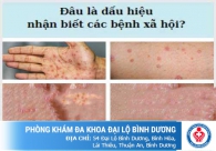 So sánh sự khác biệt giữa 4 loại bệnh tình dục phổ biến hiện nay