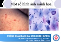Loét dương vật có phải triệu chứng bệnh xã hội nam giới hay mắc phải
