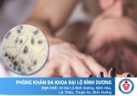 Bệnh hạ cam gồm những biểu hiện gì