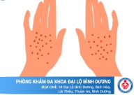 Phương pháp điều trị bệnh giang mai hiệu quả