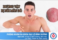 Các bệnh lý liên quan đến cậu nhỏ bị mẩn đỏ
