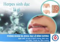 Giải đáp về bệnh herpes sinh dục