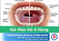 Sùi mào gà ở họng - Cẩn thận nguy cơ ung thư vòm họng
