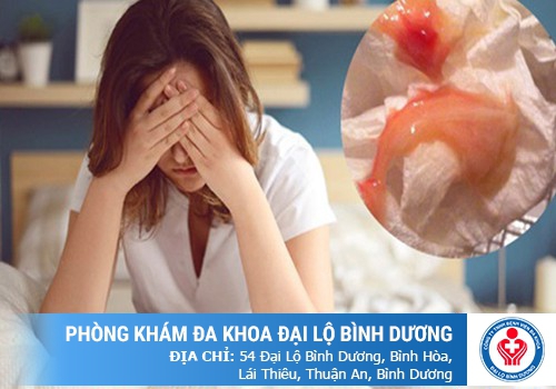 Dấu hiệu viêm nhiễm vùng kín ở phụ nữ