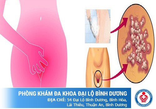 Nổi mụn vùng kín