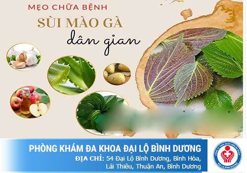 Cách chữa sùi mào gà tại nhà hiệu quả nhất
