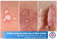 Tổng hợp các bệnh phụ khoa nam thường gặp ở nam giới