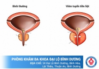 Tiểu rắt ở nam giới - tôi bị mắc bệnh gì