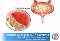 Bị viêm bàng quang có quan hệ được không