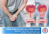 Viêm tuyến tiền liệt và những nguy hại khôn lường