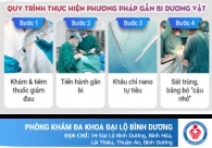 Cách làm tăng kích thước dương vật ở nam giới