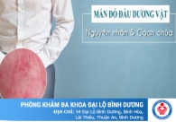 Đầu dương vật nổi mụn đỏ là bị gì