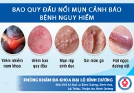 Bao quy đầu nổi mụn - Dấu hiệu cảnh báo bệnh lý nguy hiểm