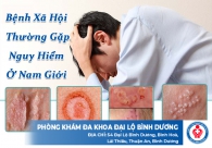 Bệnh xã hội thường gặp nguy hiểm ở nam giới