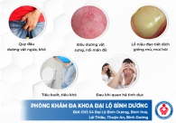 Hỗ trợ điều trị nấm dương vật như thế nào