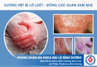 Dương vật bị lở loét chữa ngay kẻo ung thư