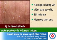 Nổi mụn trắng ở tinh hoàn là bị gì