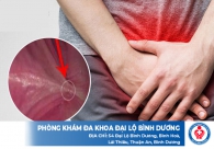 Dây hãm bao quy đầu – Những điều nam giới cần biết