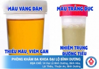 Nước tiểu đục, có bọt - dấu hiệu cảnh báo bệnh lý đường tiết niệu
