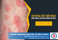 Mụn Dương Vật Dấu Hiệu Đầu Tiên Của Bệnh Xã Hội