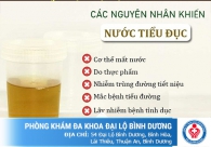 Nước tiểu đục nước tiểu vàng