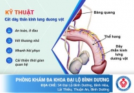 Kỹ thuật chữa xuất tinh sớm hiệu quả nhất hiện nay