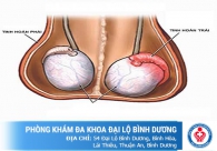 Giải mã những lý do khiến nam giới bị sưng tinh hoàn