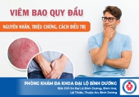 Tất tần tật về bệnh sưng đỏ bao quy đầu