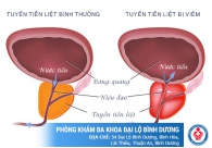 Tổng quan về bệnh ở tuyến tiền liệt nam giới nên biết