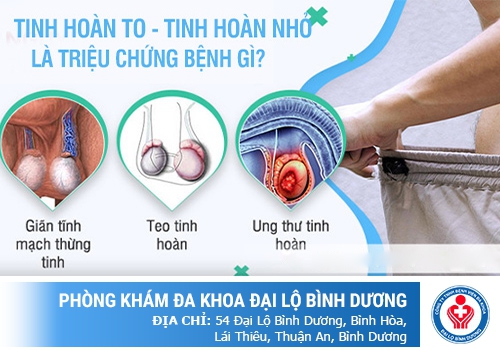 Nguyên nhân tinh hoàn bên to bên nhỏ là gì?