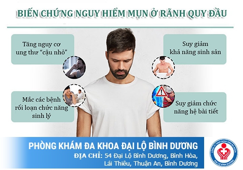 Nổi mụn ở bao quy đầu có sao không?