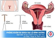 Sinh xong bao lâu có thể đặt vòng tránh thai